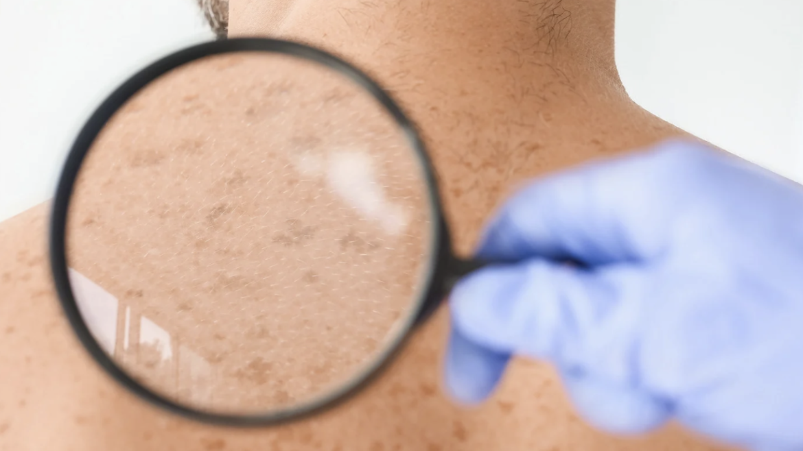 Board-Certified Psoriasis and Eczema Care in Arlington, VA